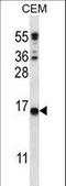 Transmembrane Protein 254 antibody, LS-C168787, Lifespan Biosciences, Western Blot image 