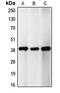 Cyclin Dependent Kinase 5 Regulatory Subunit 2 antibody, LS-C353110, Lifespan Biosciences, Western Blot image 