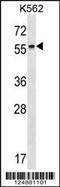 Retinoic Acid Receptor Beta antibody, TA324638, Origene, Western Blot image 