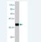 Homeobox D11 antibody, H00003237-M02, Novus Biologicals, Western Blot image 