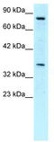 Neuronal PAS Domain Protein 1 antibody, TA329885, Origene, Western Blot image 