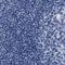 Kelch Like Family Member 41 antibody, NBP1-80787, Novus Biologicals, Immunohistochemistry paraffin image 