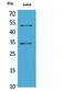 Myogenic Differentiation 1 antibody, STJ96701, St John