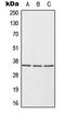 ELAV Like RNA Binding Protein 1 antibody, MBS820489, MyBioSource, Western Blot image 