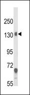 Calcium Voltage-Gated Channel Auxiliary Subunit Alpha2delta 1 antibody, GTX81084, GeneTex, Western Blot image 