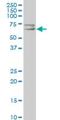 Solute Carrier Family 22 Member 4 antibody, H00006583-A01, Novus Biologicals, Western Blot image 