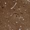 Chromosome 11 Open Reading Frame 87 antibody, PA5-57004, Invitrogen Antibodies, Immunohistochemistry paraffin image 