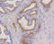 Keratin 17 antibody, abx125354, Abbexa, Immunohistochemistry paraffin image 