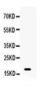 Cancer/Testis Antigen 1B antibody, A18294-1, Boster Biological Technology, Western Blot image 