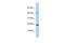 SREK1 Interacting Protein 1 antibody, GTX45214, GeneTex, Western Blot image 