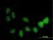 TSPY Like 4 antibody, H00023270-B01P, Novus Biologicals, Immunofluorescence image 