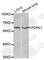 3-Phosphoinositide Dependent Protein Kinase 1 antibody, A1665, ABclonal Technology, Western Blot image 