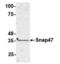 Synaptosome Associated Protein 47 antibody, 54-334, ProSci, Western Blot image 