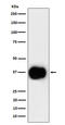 CD79b Molecule antibody, M01399-3, Boster Biological Technology, Western Blot image 