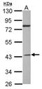 G Protein Subunit Alpha I2 antibody, NBP2-16559, Novus Biologicals, Western Blot image 