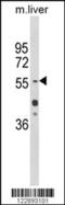 HNF1 Homeobox A antibody, 63-609, ProSci, Western Blot image 