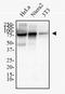 Ezrin antibody, NBP2-52977, Novus Biologicals, Western Blot image 