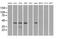 Protein Kinase CAMP-Dependent Type I Regulatory Subunit Alpha antibody, MA5-24981, Invitrogen Antibodies, Western Blot image 