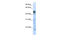 3-Oxoacyl-ACP Synthase, Mitochondrial antibody, 26-119, ProSci, Enzyme Linked Immunosorbent Assay image 