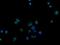 TRASK antibody, NBP2-03459, Novus Biologicals, Immunocytochemistry image 