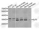E74 Like ETS Transcription Factor 5 antibody, A7181, ABclonal Technology, Western Blot image 