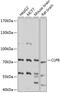 ClpB Homolog, Mitochondrial AAA ATPase Chaperonin antibody, 23-800, ProSci, Western Blot image 