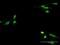 Creatine Kinase, M-Type antibody, H00001158-M06, Novus Biologicals, Immunocytochemistry image 