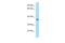 Retinol Dehydrogenase 8 antibody, A10565, Boster Biological Technology, Western Blot image 