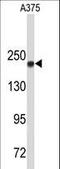 DNA Topoisomerase II Alpha antibody, LS-C160114, Lifespan Biosciences, Western Blot image 