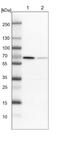Family With Sequence Similarity 160 Member B2 antibody, NBP1-92313, Novus Biologicals, Western Blot image 