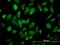 Nuclear receptor coactivator 4 antibody, H00008031-M05, Novus Biologicals, Immunocytochemistry image 