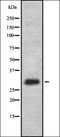 Golgi Membrane Protein 1 antibody, orb337036, Biorbyt, Western Blot image 