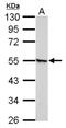 Retinoic Acid Receptor Gamma antibody, NBP2-15098, Novus Biologicals, Western Blot image 