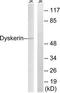 Dyskerin Pseudouridine Synthase 1 antibody, TA313752, Origene, Western Blot image 