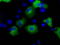 Transforming Acidic Coiled-Coil Containing Protein 3 antibody, TA501260, Origene, Immunofluorescence image 