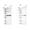 Mitochondrial Trans-2-Enoyl-CoA Reductase antibody, NBP1-85659, Novus Biologicals, Western Blot image 
