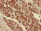 Parvin Alpha antibody, LS-C673907, Lifespan Biosciences, Immunohistochemistry paraffin image 