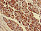 Parvin Alpha antibody, LS-C673907, Lifespan Biosciences, Immunohistochemistry paraffin image 