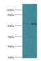 Interleukin 7 Receptor antibody, LS-C375967, Lifespan Biosciences, Western Blot image 