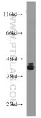 Phosphatidylinositol Glycan Anchor Biosynthesis Class K antibody, 15151-1-AP, Proteintech Group, Western Blot image 