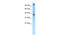 Zinc Finger Protein 624 antibody, 27-754, ProSci, Western Blot image 