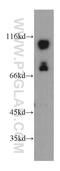 Protein Phosphatase 4 Regulatory Subunit 3B antibody, 20348-1-AP, Proteintech Group, Western Blot image 
