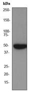 Protein Kinase CAMP-Dependent Type II Regulatory Subunit Beta antibody, ab75993, Abcam, Western Blot image 