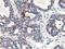 Nudix Hydrolase 18 antibody, TA503830, Origene, Immunohistochemistry paraffin image 