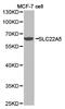 Solute Carrier Family 22 Member 5 antibody, LS-C192902, Lifespan Biosciences, Western Blot image 