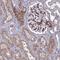 Tensin-1 antibody, HPA036089, Atlas Antibodies, Immunohistochemistry paraffin image 