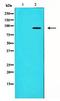 ADAM Metallopeptidase Domain 17 antibody, orb137133, Biorbyt, Western Blot image 