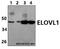 ELOVL Fatty Acid Elongase 1 antibody, A07612-1, Boster Biological Technology, Western Blot image 