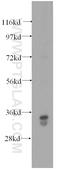 Glycine-N-Acyltransferase Like 1 antibody, 15717-1-AP, Proteintech Group, Western Blot image 