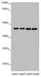 Pyruvate Dehydrogenase E1 Alpha 2 Subunit antibody, LS-C676237, Lifespan Biosciences, Western Blot image 